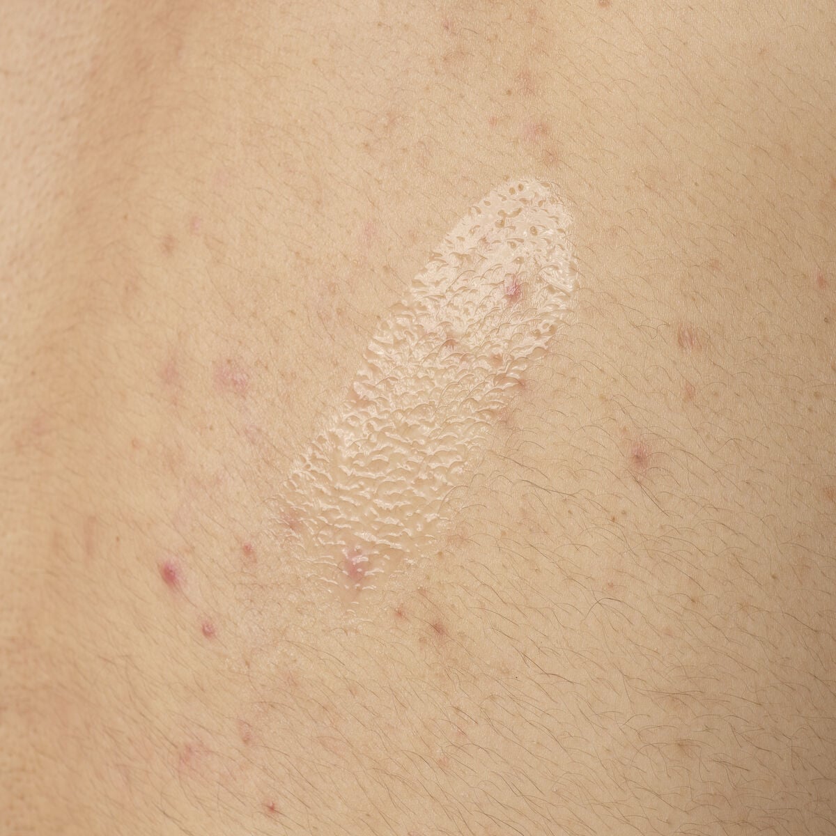 salicylic-acid-0-5-body-serum-t6 ORD-salicylic-acid-05-body-240ml-application.jpg