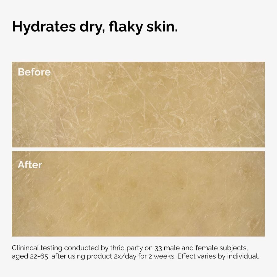 the-body-care-collection-w8 ord-natural-moisturizing-factors-inulin-body-before-after-graphic-02.jpg