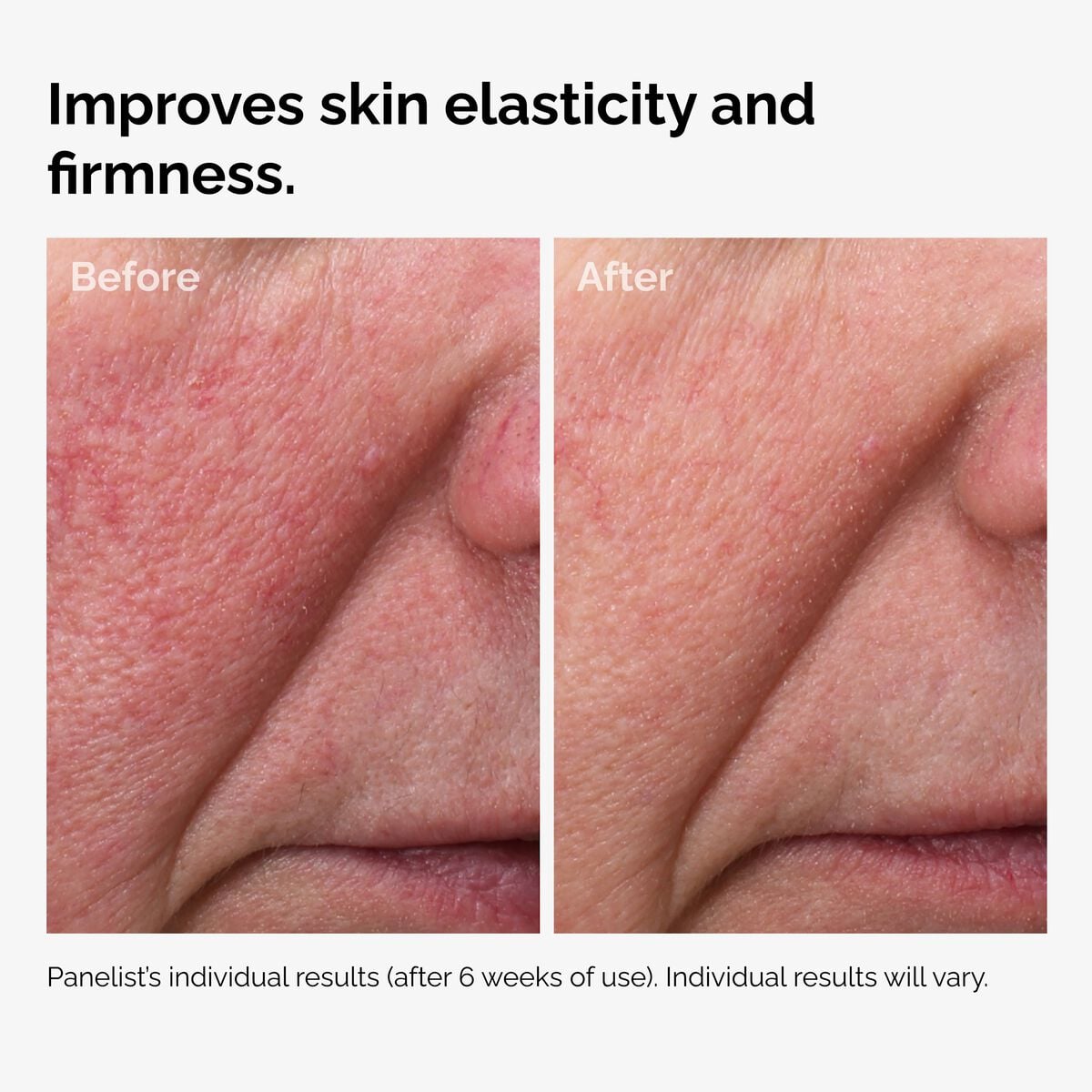 100-fermented-rose-hip-seed-oil-g1 100pct-fermented-rose-hip-before-after-elasticity.jpg