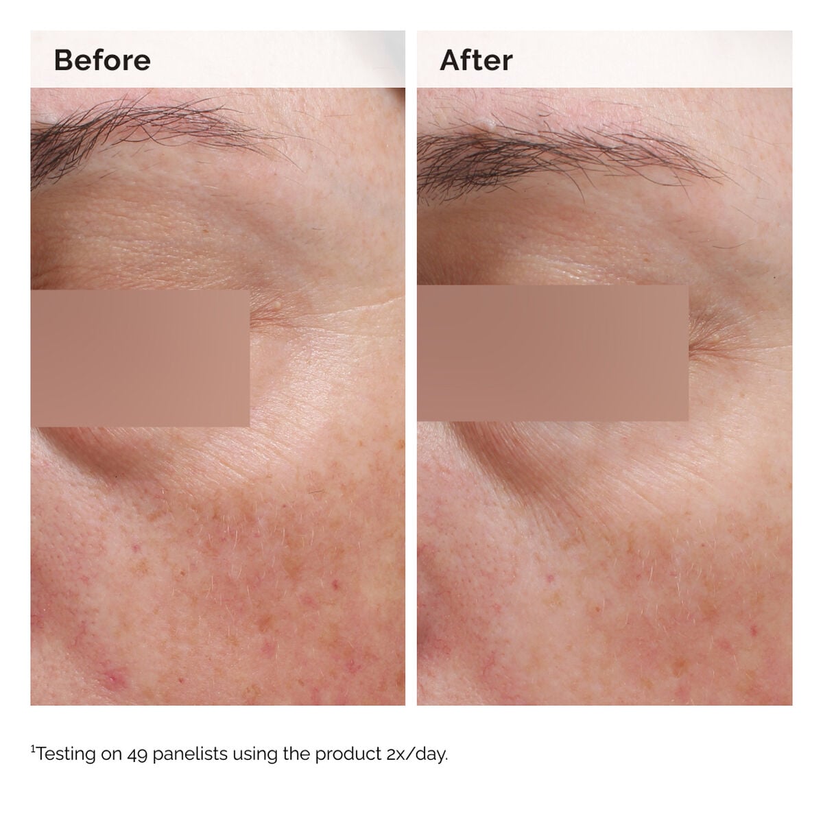niacinamide-5-face-and-body-emulsion-c7 2024-08-23-ORD-Nia-5pct-Face-Body-B-A-Elasticity-Global-02-1x1.jpg