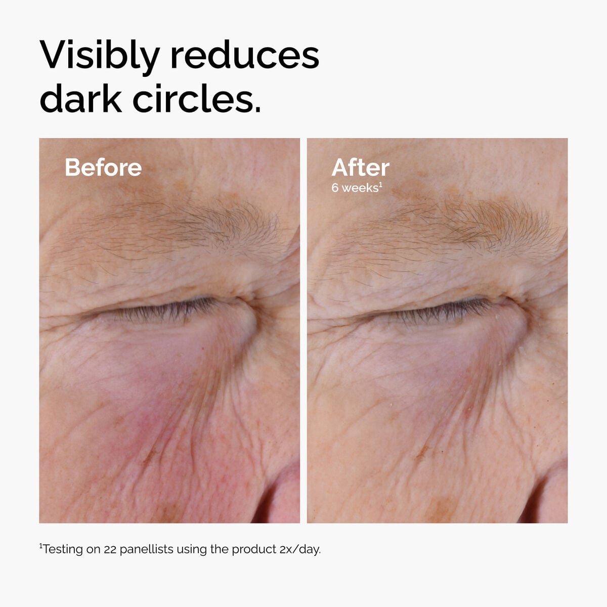 caffeine-solution-5-egcg-eye-serum-u4 ord-caffeine-solution-egcg-dark-circles-before-after.jpg