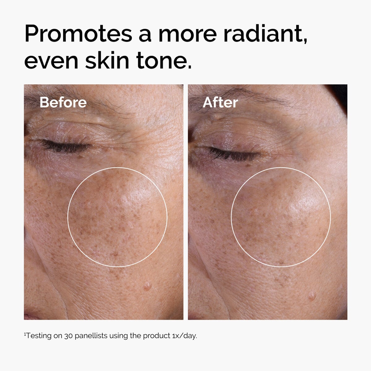 glycolic-acid-7-exfoliating-toner-i6 ord-glycolic-before-after-radiance.jpg