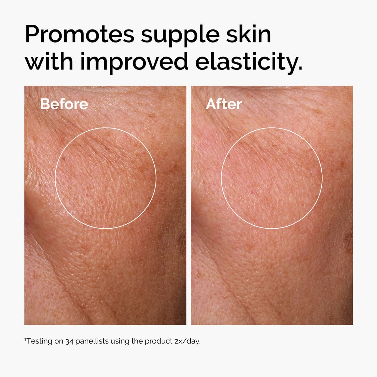 hyaluronic-acid-2-b5-with-ceramides-i5 ord-hyaluronic-acid-2pct-b5-hydrating-serum-before-after-elasticity.jpg