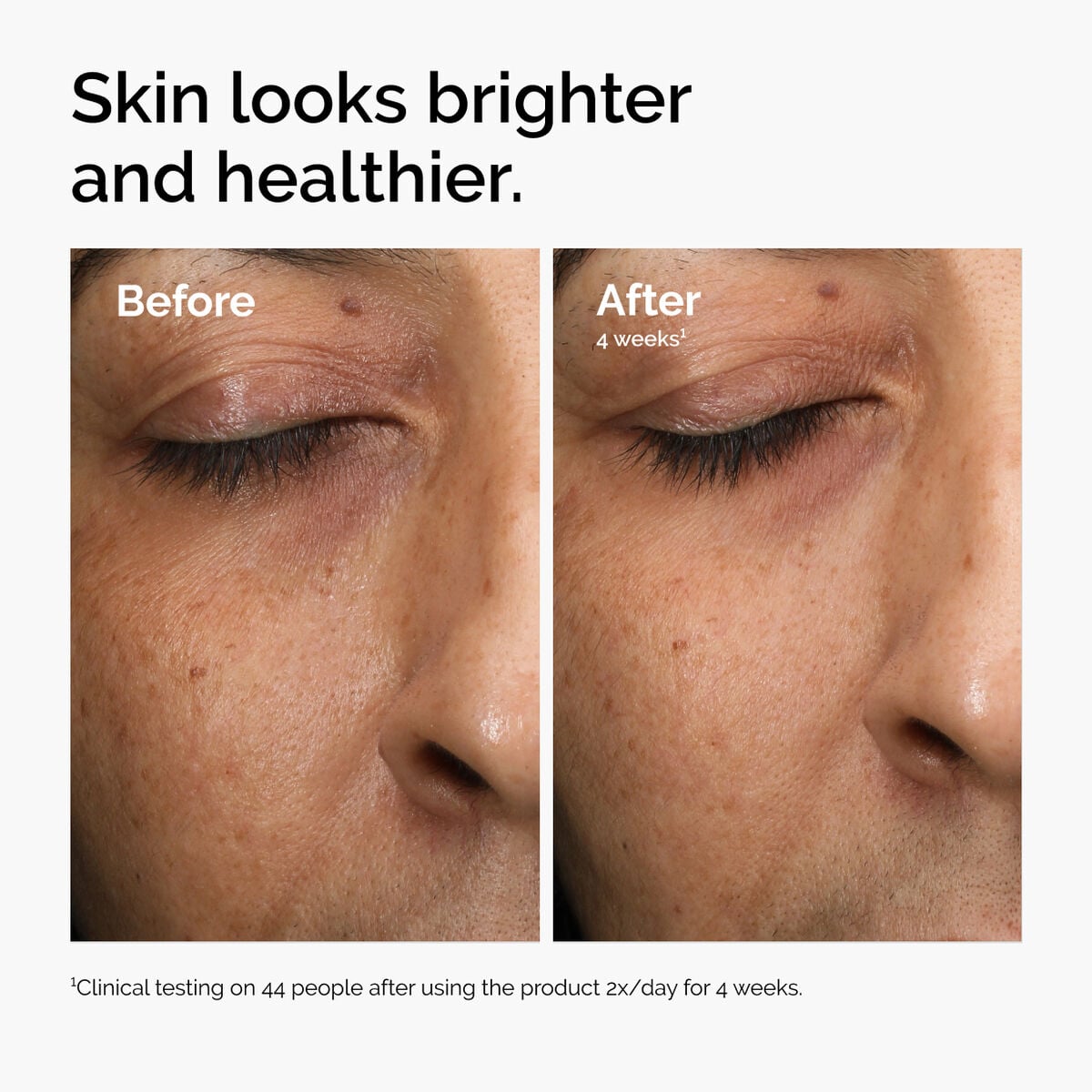 multi-antioxidant-radiance-serum-i7 ord-mars-before-after-healthy.jpg