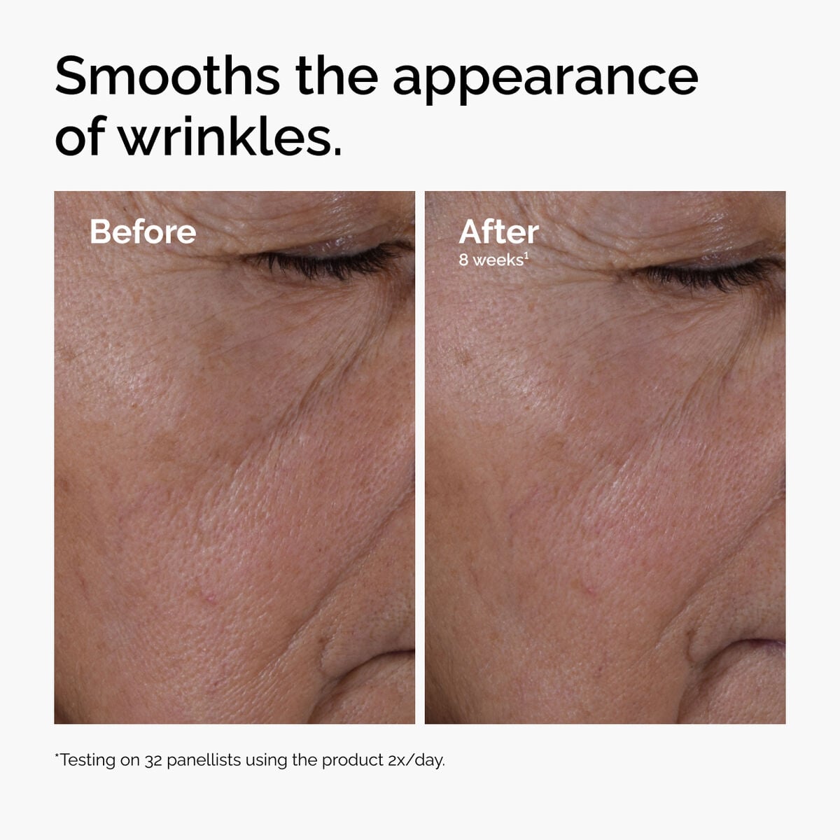 multi-peptide-ha-serum-m9 ord-multi-peptide-ha-serum-wrinkles-before-after.jpg