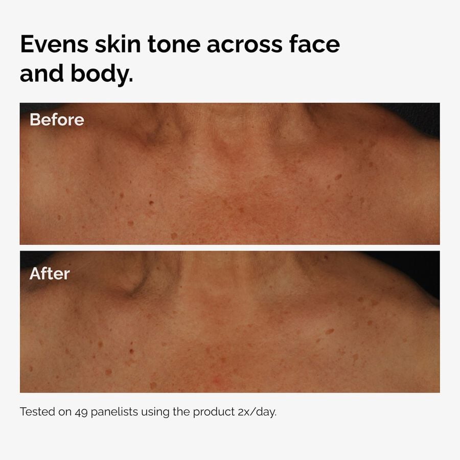 the-body-care-collection-w8 ord-niacinamide-face-body-serum-before-after-even-tone-graphic.jpg