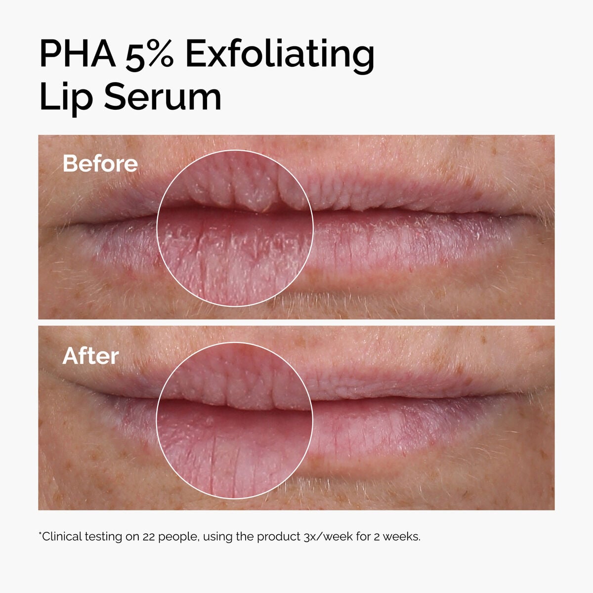 pha-5-exfoliating-lip-serum-w8 ord-pha-5pct-lip-exfoliating-serum-before-after.jpg