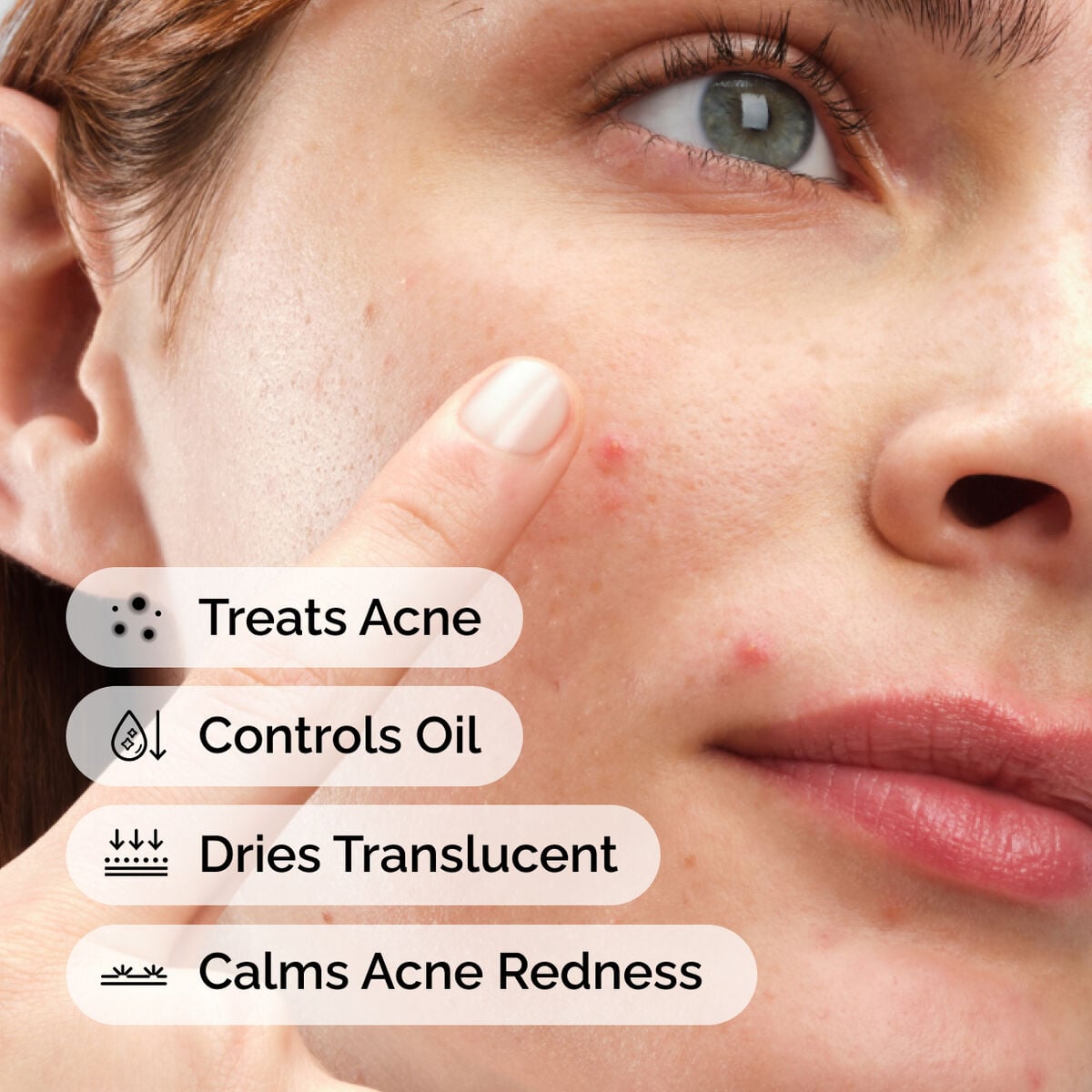 sulfur-10-powder-to-cream-concentrate-x2 ord-sulfur-10pct-powder-to-cream-concentrate-model-application-with-benefits-acne.jpg